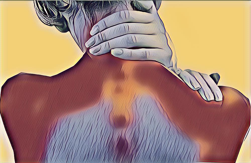 Cupping Points for Neck and Shoulder Pain